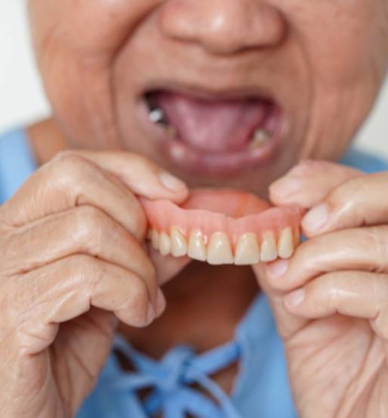 Dentures2