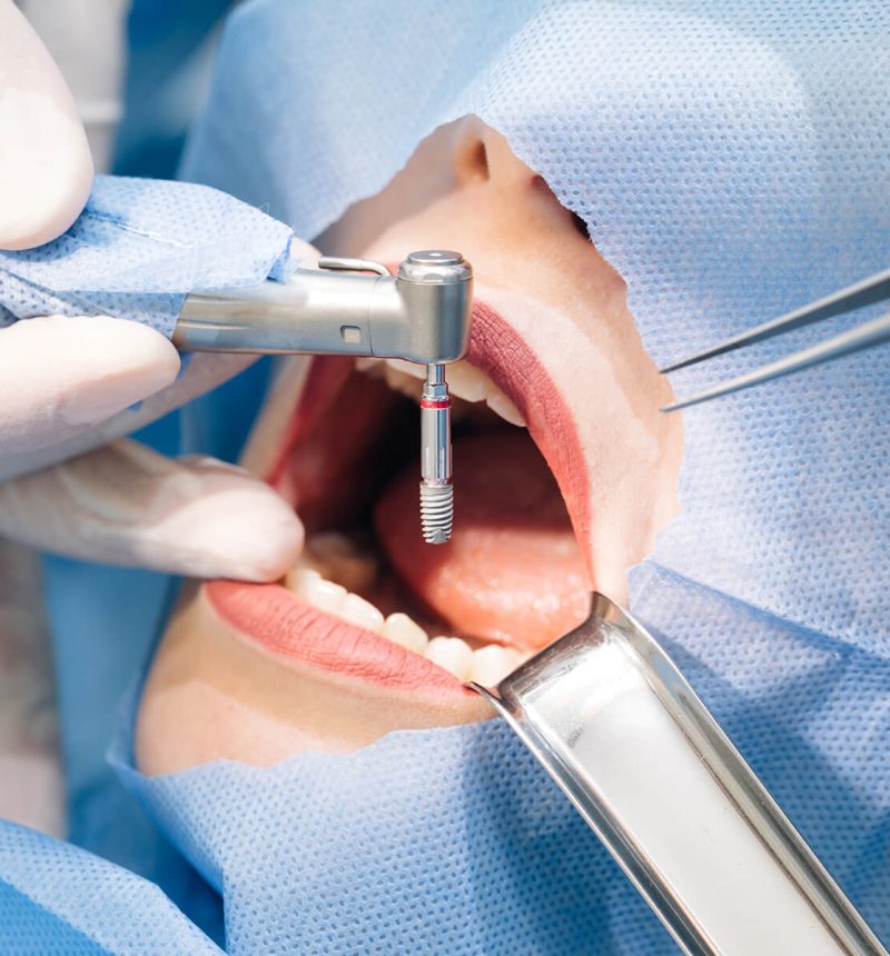 Endodontics